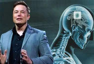 Kabel Neuralink di Otak Pasien Lepas, Elon Musk Cari Pasien Kedua
